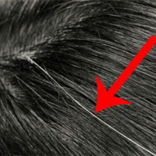 DEZE natuurlijke huismiddelen zijn tegen vroegtijdige grijze haren.
