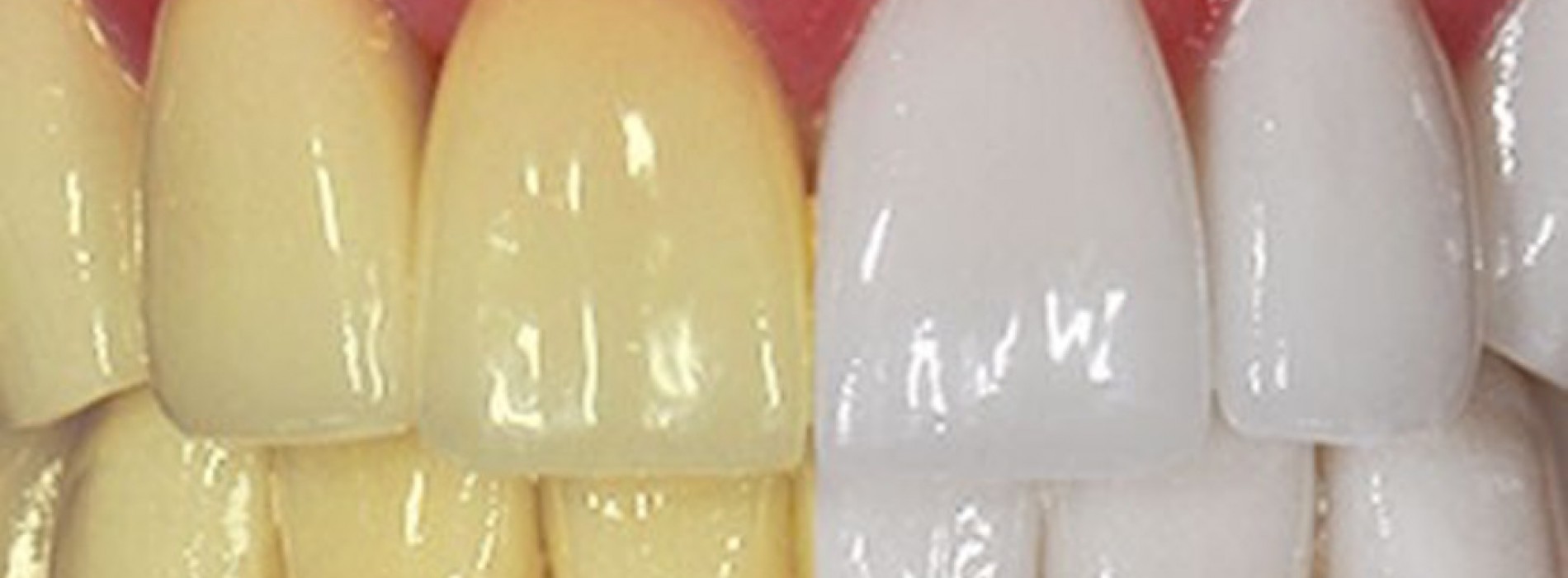 9 Tips om je tanden op een natuurlijk manier witter te maken.
