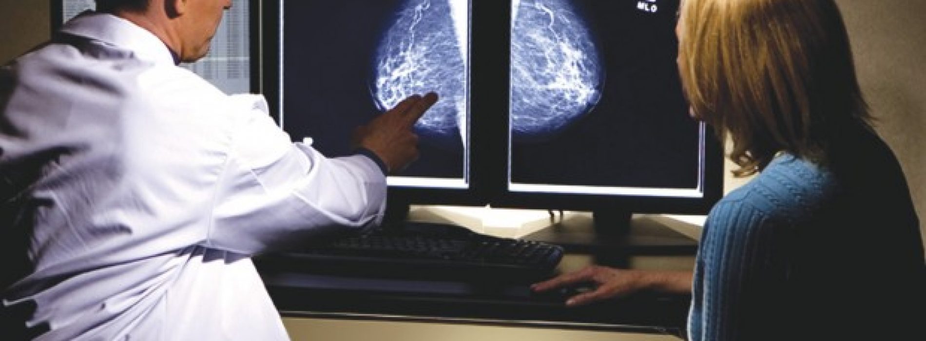 Vrouwen opgelet: “Mammografie leidt niet tot minder sterfgevallen en verhoogt juist het risico op kanker”