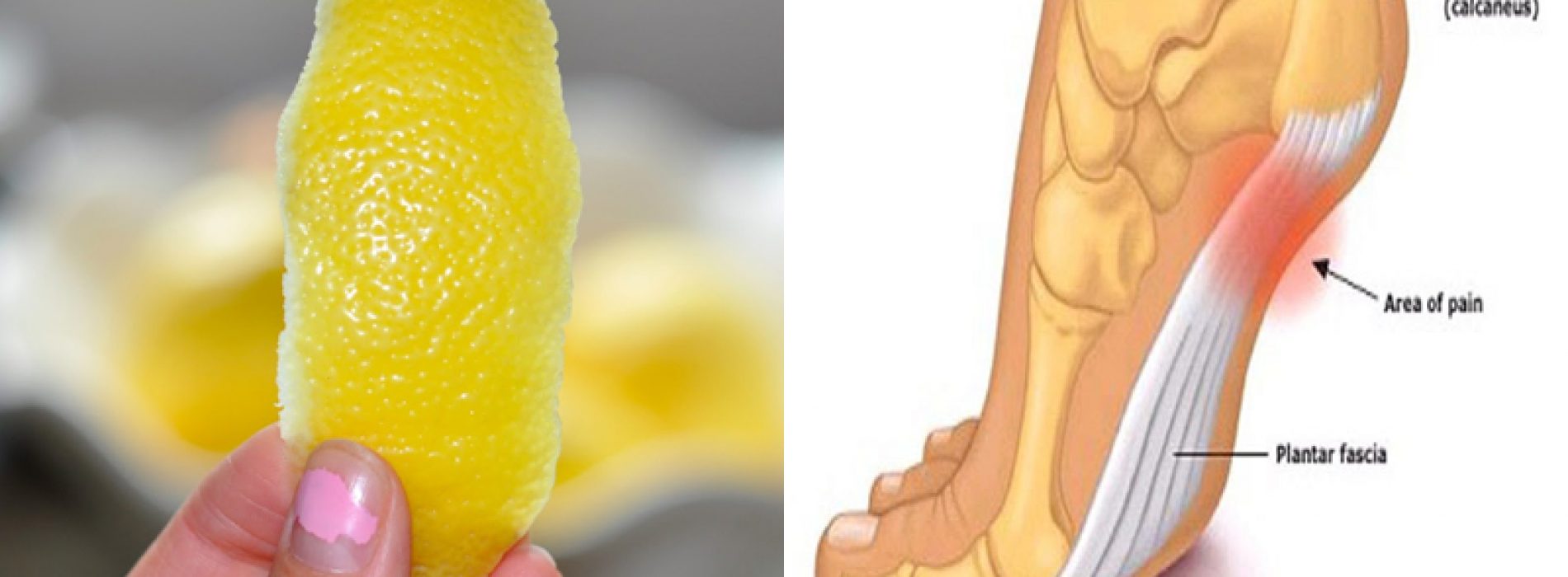 De 1 citroen truc om van ontstekingspijn en chronische pijn af te komen!