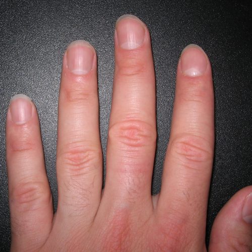Dit is wat de vorm en grootte van je nagels over jou zegt!