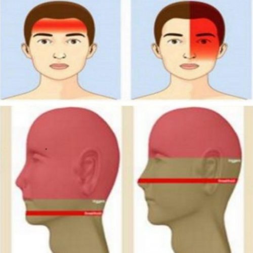 Deze 4 verschillende vormen van hoofdpijn vertellen jou iets over je gezondheid