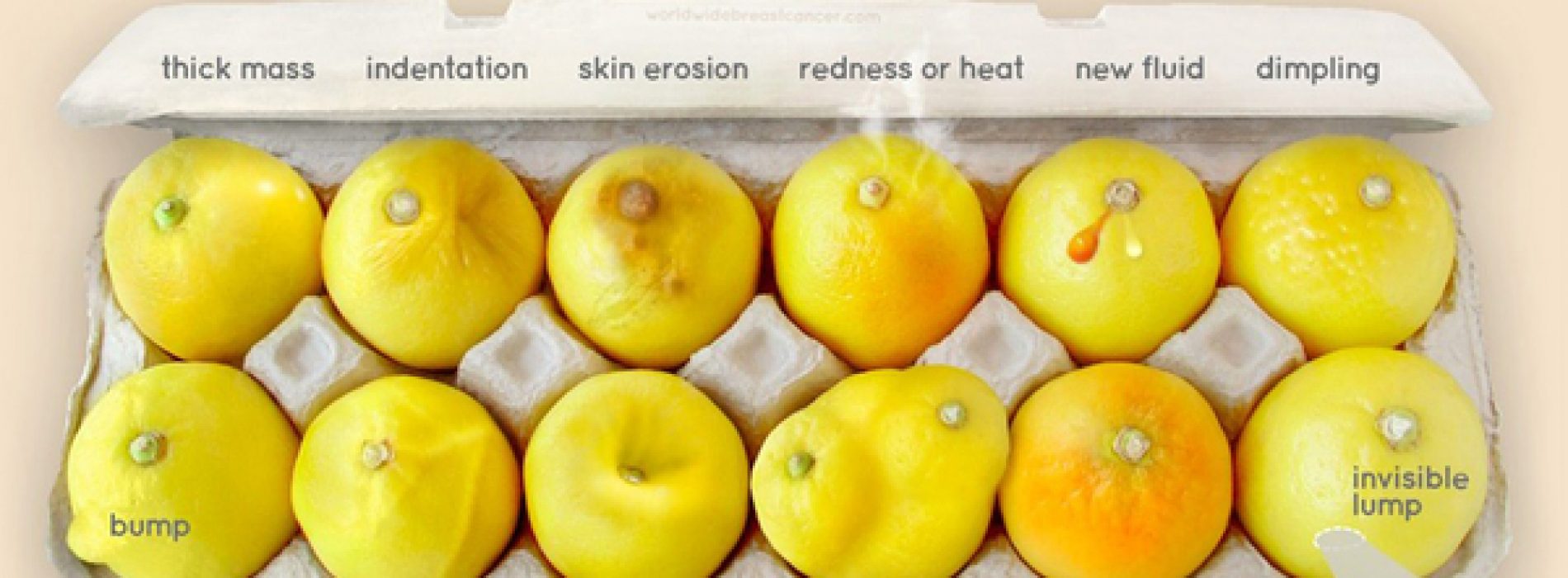 Herken je deze tekenen van borst kanker? Deze foto van citroenen kan levens redden!