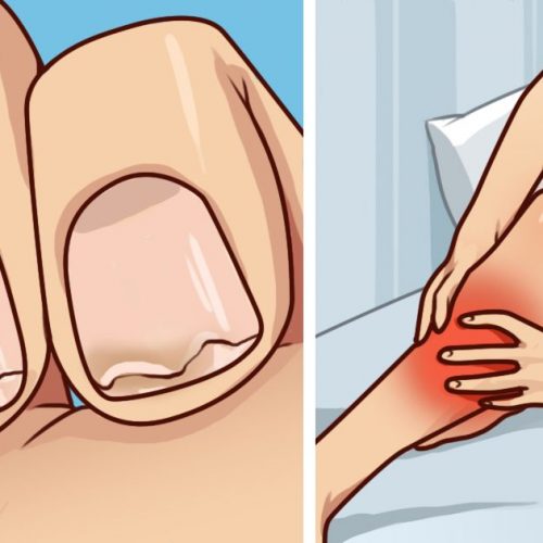 Heb je broze nagels? Vaak last van beenkrampen? Dit is wat je moet weten!