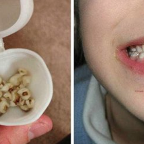Onderzoekers dringen aan: gooi de melktanden van je kind niet weg! Ze kunnen levens redden!