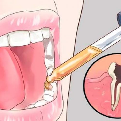 Doe dit in je mond en je vervelende tandpijn verdwijnt binnen enkele seconden