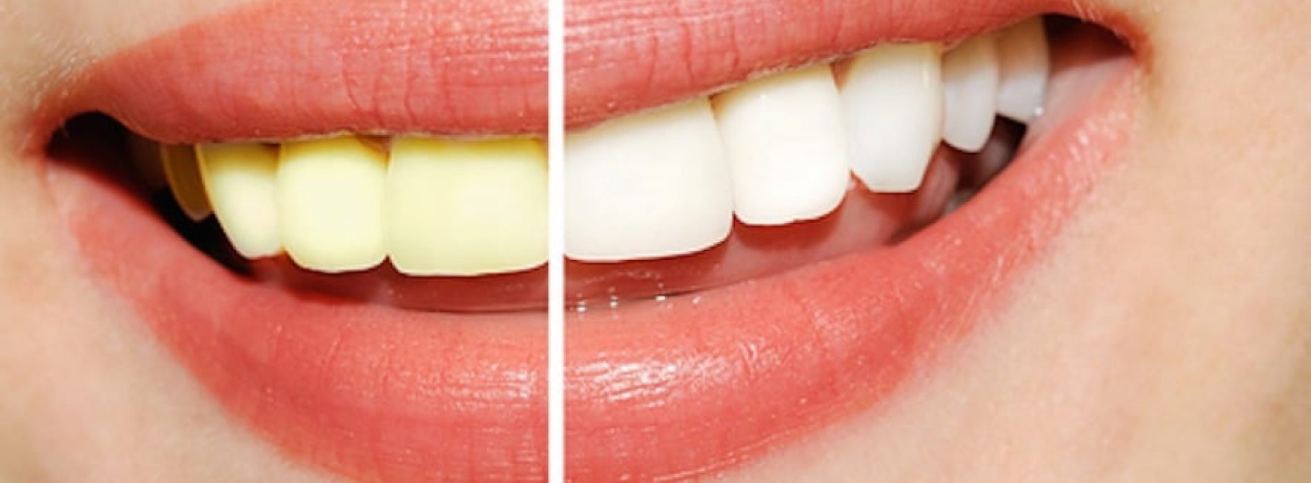 Een stralende witte lach zonder je tanden te bleken? Met DEZE tips gaat dat lukken!