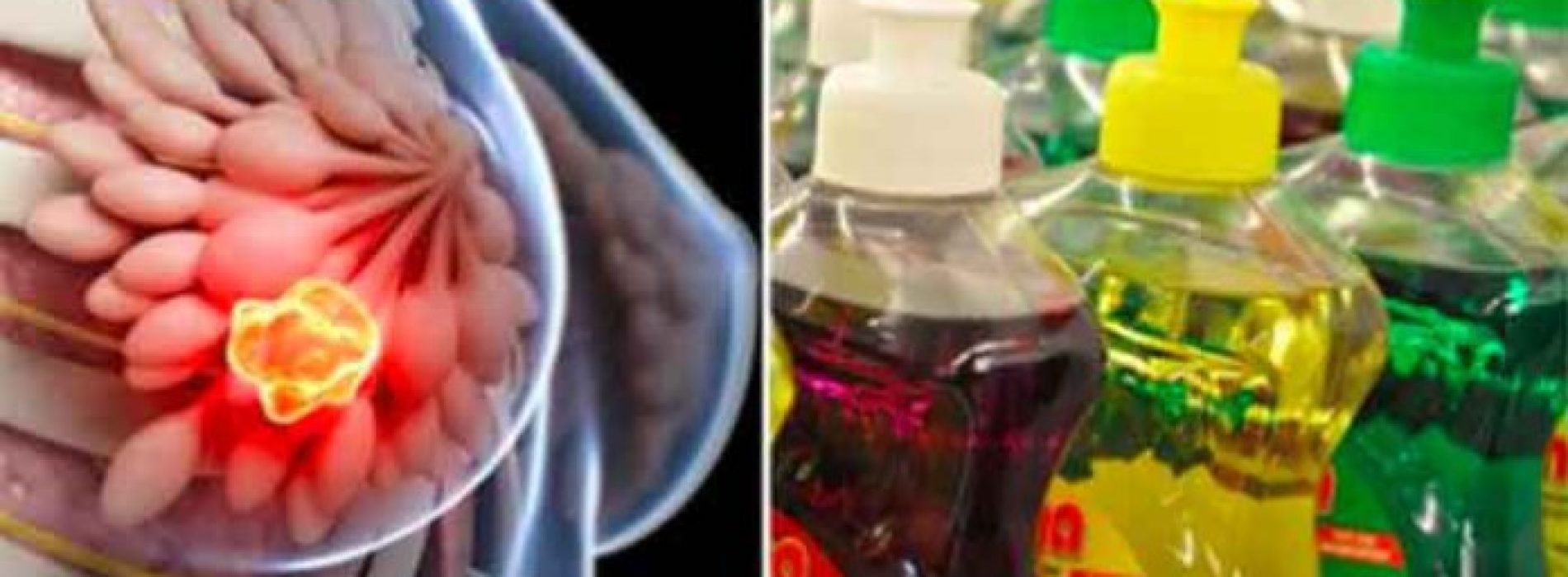 6 Gevaarlijke afwasmiddelen die Vol zitten met kankerverwekkende chemische stoffen!