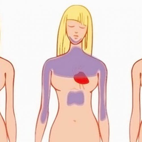 Een maand voor een hartinfarct begint je lichaam je al te waarschuwen, dit zijn 6 aanwijzingen speciaal voor vrouwen.