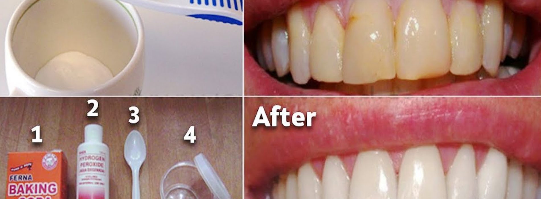 Dit mondwater verwijdert tandplak van tanden in 2 minuten