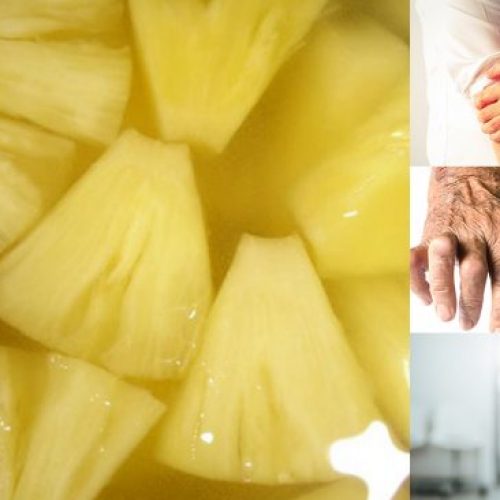 Dit ananaswater kan gewrichtspijn, ontstekingen verlichten en zal u helpen gewicht te verliezen