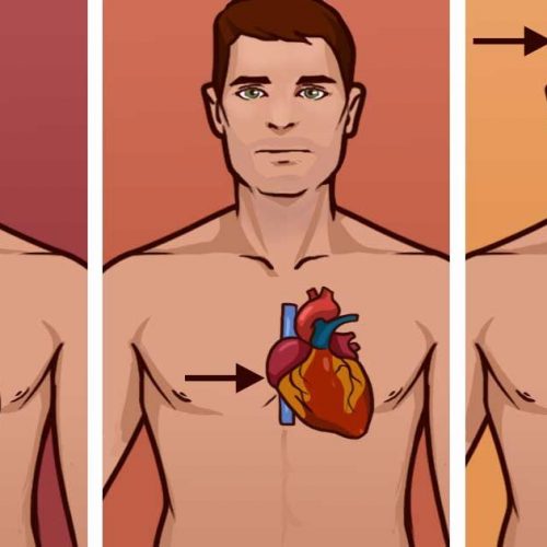 Ken het verschil tussen een hartaanval, een hartstilstand en een beroerte. Het kan een leven redden