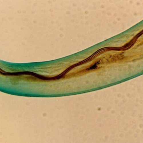 Hawaii waarschuwt toeristen voor parasitaire wormen die zich in menselijke hersenen kunnen nestelen