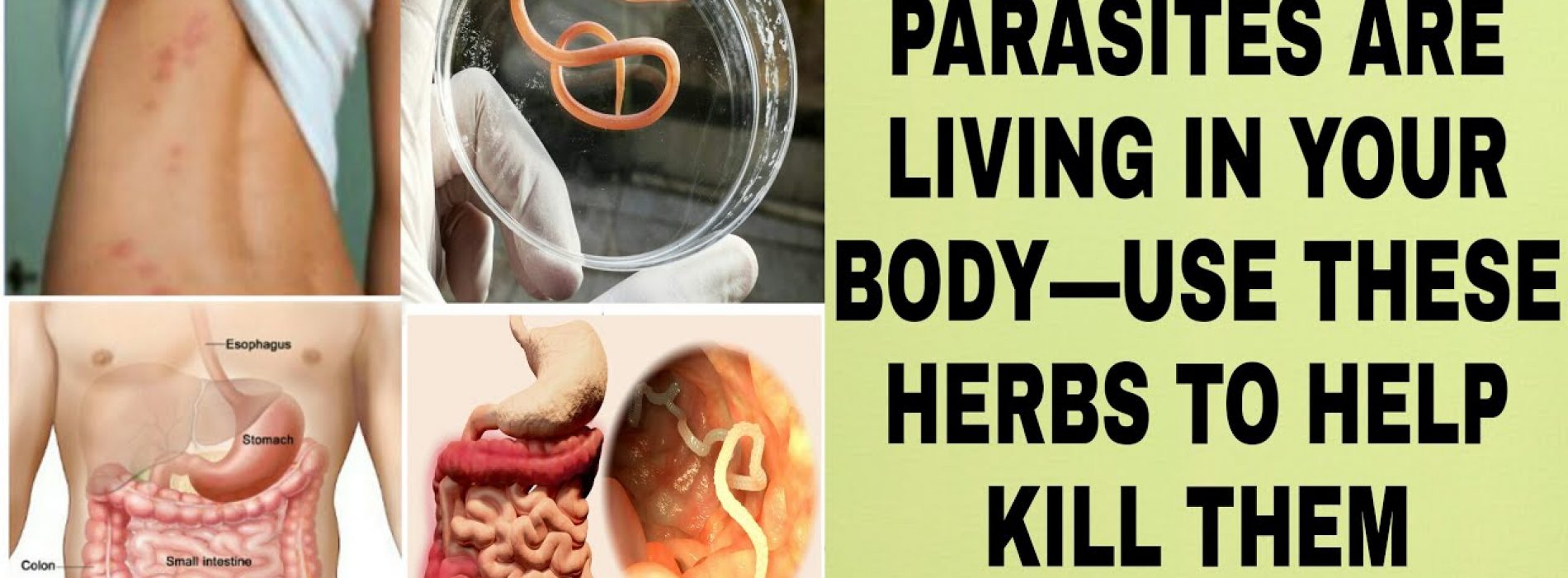 21 tekens dat er parasieten leven in je lichaam – Gebruik deze kruiden om ze te doden