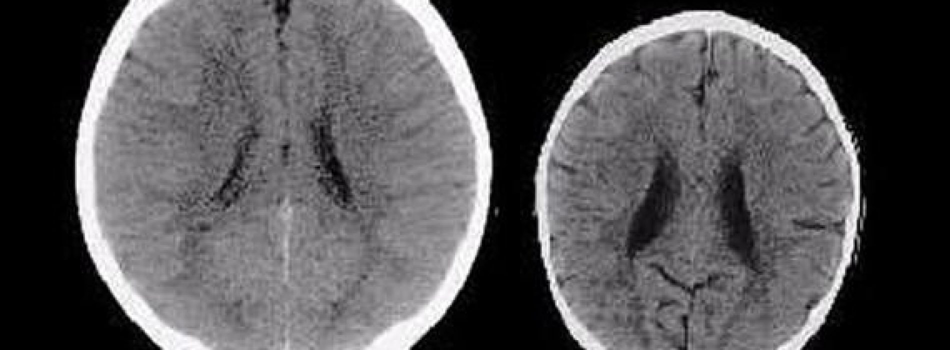 Hersenscans laten de echte impact zien die liefde heeft op de hersenen van een kind