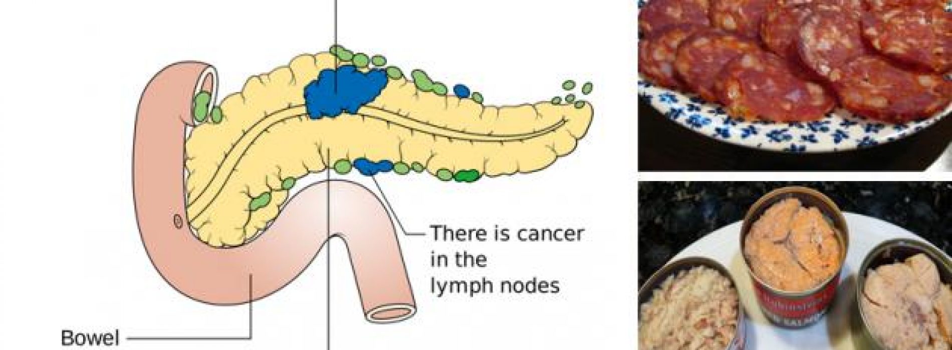 11 Kanker veroorzakende voedingsmiddelen die u nooit meer in uw mond zou moeten stoppen