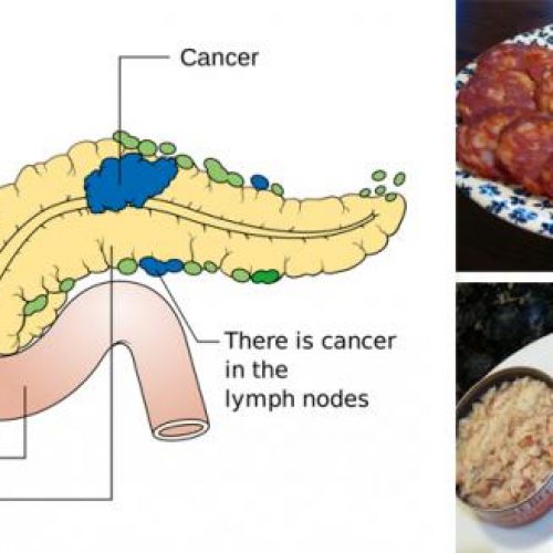 11 Kanker veroorzakende voedingsmiddelen die u nooit meer in uw mond zou moeten stoppen