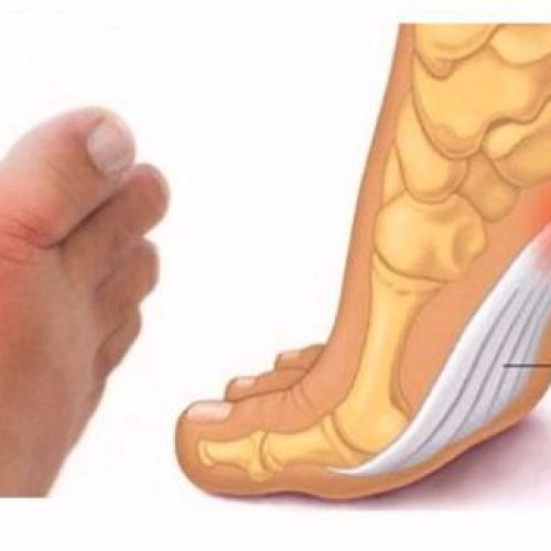Controleer je voeten en kijk wat ze je vertellen over je bloeddruk, schildklier- en artritis risico