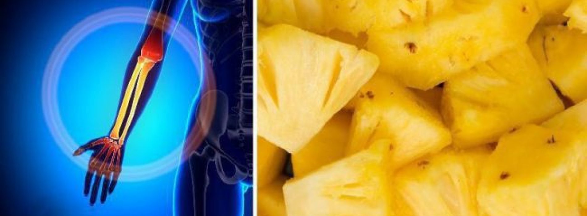 8 redenen waarom je vandaag moet beginnen met het eten van ananas!