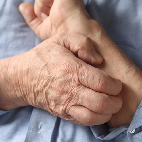 Tekenen van artritis waar u op moet letten en wat u vervolgens moet doen